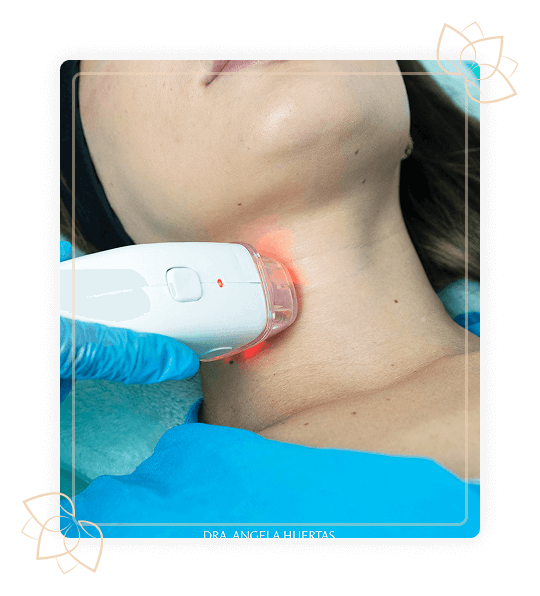 procedimiento contour shape facial