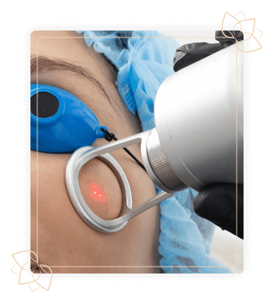 procedimiento laser fraccionado co2